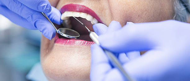 Best Emergency Dental Care for Broken or Chipped Teeth in Frankfort Square, IL